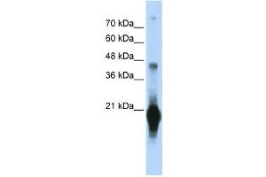 Western Blotting (WB) image for anti-Chromosome 17 Open Reading Frame 49 (C17orf49) antibody (ABIN2459653)