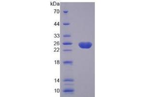 SDS-PAGE of Protein Standard from the Kit  (Highly purified E. (Caspase 8 ELISA Kit)