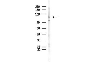 anti-Phospholipase A2, Group VI (Cytosolic, Calcium-Independent) (PLA2G6) (Internal Region) antibody