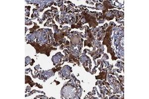 Immunohistochemical staining of human lung with DNHD1 polyclonal antibody  shows strong cytoplasmic positivity in macrophages. (DNHD1 antibody)