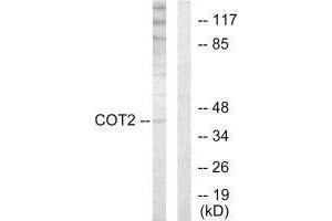 Western blot analysis of extracts from HUVEC cells, using COT2 antibody.