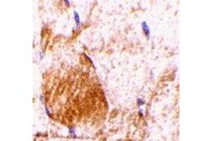 Immunohistochemistry (IHC) image for anti-Interleukin 31 (IL31) (N-Term) antibody (ABIN1031414) (IL-31 antibody  (N-Term))