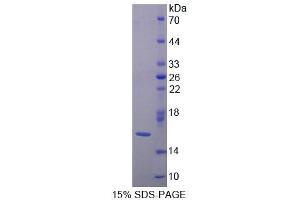 SDS-PAGE (SDS) image for Lectin, Galactoside-Binding, Soluble, 9B (LGALS9B) (AA 17-148) protein (His tag) (ABIN1170505)