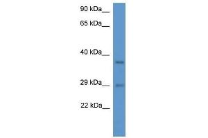 Western Blot showing Med19 antibody used at a concentration of 1.