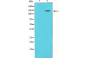 Western blot analysis of p130 Cas expression in NIH-3T3 whole cell lysates,The lane on the left is treated with the antigen-specific peptide. (BCAR1 antibody  (Internal Region))