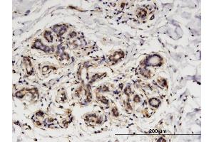 Immunoperoxidase of monoclonal antibody to GNA14 on formalin-fixed paraffin-embedded human breast.