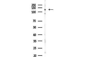 anti-ArfGAP with SH3 Domain, Ankyrin Repeat and PH Domain 1 (ASAP1) (Internal Region) antibody