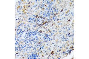 Immunohistochemistry of paraffin-embedded rat spleen using C Rabbit mAb (ABIN7266125) at dilution of 1:100 (40x lens). (CARD11 antibody)