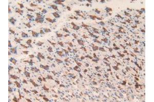 Figure. (MGST1 antibody  (AA 8-155))