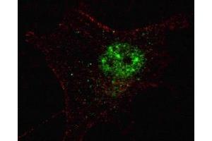 Fluorescent confocal image of SY5Y cells stained with PDX1 antibody. (PDX1 antibody  (AA 1-30))