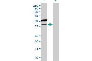 Western Blot analysis of B3GNT5 expression in transfected 293T cell line by B3GNT5 MaxPab polyclonal antibody. (B3GNT5 antibody  (AA 1-378))