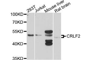 Western blot analysis of extracts of various cell lines, using CRLF2 antibody. (CRLF2 antibody)