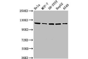 Western Blot Positive WB detected in: Hela whole cell lysate, MCF-7 whole cell lysate, SH-SY5Y whole cell lysate, HepG2 whole cell lysate, A549 whole cell lysate All lanes: USP48 antibody at 3.