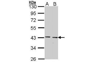 WB Image Sample (30 ug of whole cell lysate) A: Hep G2 , B: Molt-4 , 10% SDS PAGE antibody diluted at 1:1000 (GULP1 antibody  (C-Term))