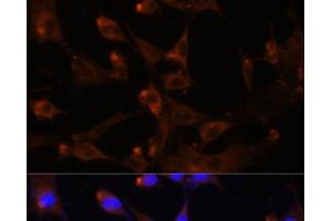 Immunofluorescence analysis of NIH-3T3 cells using CAD Polyclonal Antibody at dilution of 1:100. (CAD antibody)