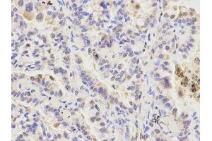 Immunohistochemistry (IHC) image for anti-Autophagy related 4A Cysteine Peptidase (ATG4A) antibody (ABIN1871138)