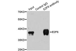 Immunoprecipitation analysis of 200 μg extracts of MCF-7 cells using 3 μg E2F6 antibody (ABIN5973627).