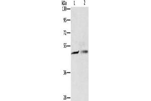 Gel: 8 % SDS-PAGE, Lysate: 40 μg, Lane 1-2: A549 cells, A375 cells, Primary antibody: ABIN7130597(PGBD4 Antibody) at dilution 1/250, Secondary antibody: Goat anti rabbit IgG at 1/8000 dilution, Exposure time: 5 seconds (PGBD4 antibody)