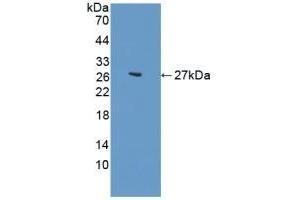 Detection of Recombinant CDH2, Human using Polyclonal Antibody to N-cadherin (NCAD) (N-Cadherin antibody  (AA 50-276))
