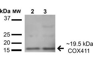 Western blot analysis of Human A549 cell lysates showing detection of 19.