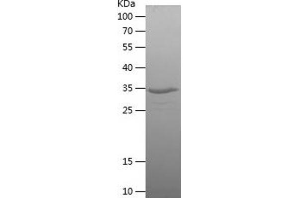 SNRPN Protein (AA 73-173) (His-IF2DI Tag)