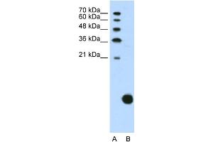 WB Suggested Anti-RPS29 Antibody Titration:  1. (RPS29 antibody  (N-Term))