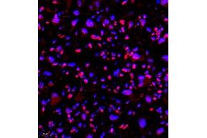 Immunofluorescence of paraffin embedded mouse placenta using SMNDC1 (ABIN7075773) at dilution of 1:650 (400x lens) (SMNDC1 antibody)