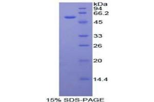 SDS-PAGE analysis of Mouse FOXP3 Protein. (FOXP3 Protein)