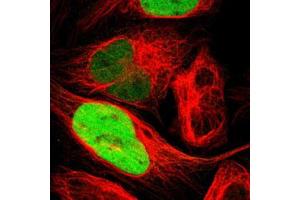 Immunofluorescent staining of U-2 OS with TPX2 polyclonal antibody  (Green) shows positivity in nucleus but excluded from the nucleoli.