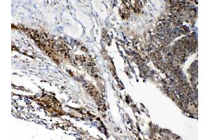 IHC analysis of STAT1 using anti- STAT1 antibody . (STAT1 antibody  (AA 2-230))