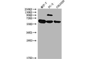Western Blot Positive WB detected in: MCF-7 whole cell lysate, PC-3 whole cell lysate, COLO320 whole cell lysate All lanes: SRC antibody at 1:2000 Secondary Goat polyclonal to rabbit IgG at 1/50000 dilution Predicted band size: 60, 61 kDa Observed band size: 60 kDa (Src antibody  (AA 2-100))