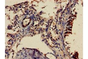 Immunohistochemistry of paraffin-embedded human lung tissue using ABIN7158098 at dilution of 1:100 (SHoc2/Sur8 antibody  (AA 3-89))