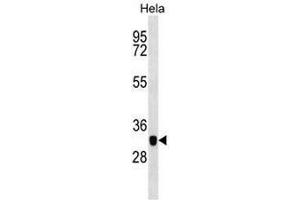 Western blot analysis in Hela cell line lysates (35µg/lane) using CAPG Antibody . (CAPG antibody  (Middle Region))