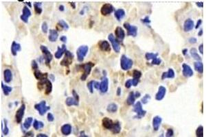 Immunohistochemistry (Paraffin-embedded Sections) (IHC (p)) image for anti-CD63 (CD63) antibody (ABIN7073400)