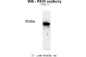 Image no. 1 for anti-Peptidyl Arginine Deiminase, Type II (PADI2) antibody (ABIN346986) (PADI2 antibody)