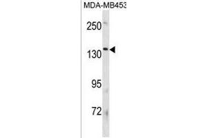 ATP8B3 Antibody (N-term) (ABIN1881094 and ABIN2839049) western blot analysis in MDA-M cell line lysates (35 μg/lane).