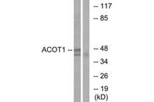 Western blot analysis of extracts from Jurkat cells, using ACOT1 Antibody. (ACOT1 antibody  (AA 91-140))