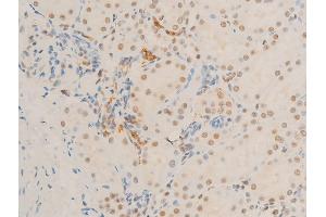ABIN6267271 at 1/100 staining rat kidney tissue sections by IHC-P. (c-MYC antibody  (pSer62))