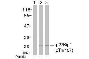 Image no. 1 for anti-Cyclin-Dependent Kinase Inhibitor 1B (p27, Kip1) (CDKN1B) (pThr187) antibody (ABIN196946) (CDKN1B antibody  (pThr187))