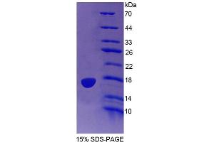 SDS-PAGE (SDS) image for Protein Tyrosine Phosphatase, Mitochondrial 1 (PTPMT1) (AA 71-197) protein (His tag) (ABIN4989887)