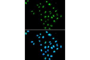 Immunofluorescence analysis of MCF-7 cells using EIF6 antibody. (EIF6 antibody)