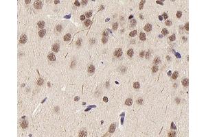 Immunohistochemistry analysis of paraffin-embedded rat brain using HDAC1 Polyclonal Antibody at dilution of 1:300. (HDAC1 antibody)