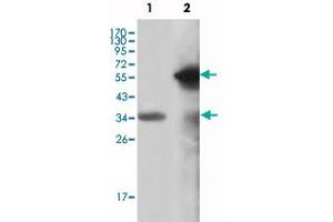Western blot analysis using MLL monoclonal antibody, clone 10F8D7  against truncated MLL recombinant protein (1) and truncated GFP-MLL(aa 3714-3969) transfected COS-7 cell lysate (2). (MLL/KMT2A antibody)