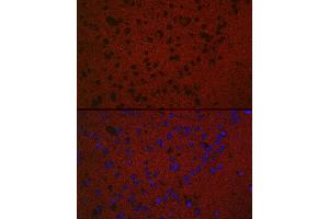Immunofluorescence analysis of Mouse brain using RA antibody (ABIN7269809) at dilution of 1:50. (RAB3A antibody  (AA 100-200))