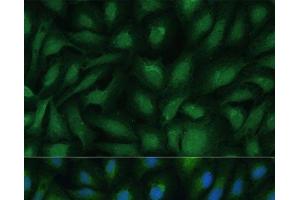 Immunofluorescence analysis of U-2 OS cells using COG2 Polyclonal Antibody at dilution of 1:100 (40x lens). (COG2 antibody)
