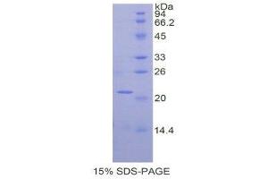 SDS-PAGE (SDS) image for Spectrin alpha Chain, Brain (SPTAN1) (AA 1049-1207) protein (His tag) (ABIN1877803) (SPTAN1 Protein (AA 1049-1207) (His tag))