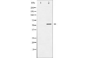 MEF2A antibody  (pThr319)