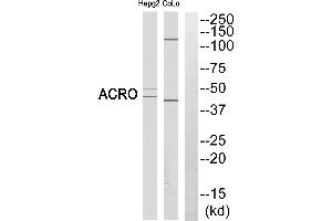 Western blot analysis of extracts from HEPG2 cells and COLO cells, using ACRO (heavy chain, Cleaved-Ilantibody.