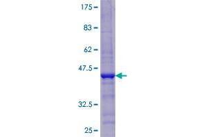 CDKAL1 Protein (AA 1-97) (GST tag)