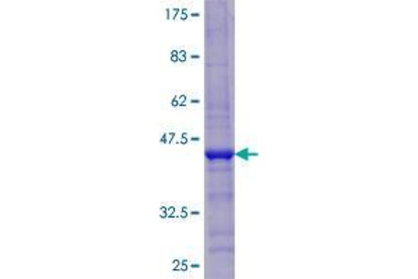 CDKAL1 Protein (AA 1-97) (GST tag)